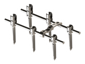 EDEN™ Spinal Fixation System