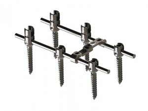 EDEN™ Spinal Fixation System