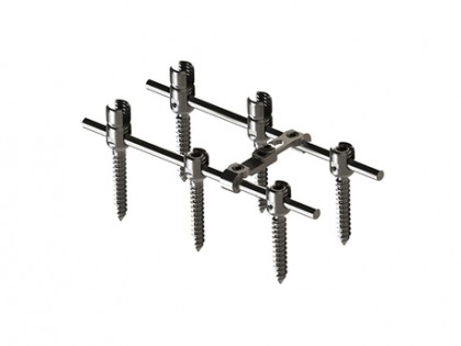 EDEN™ Spinal Fixation System