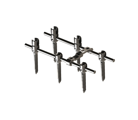 EDEN™ Spinal Fixation System