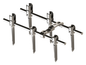 EDEN™ Spinal Fixation System